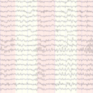 NEUROFEEDBACK MANCHE Betton, Entreprise locale